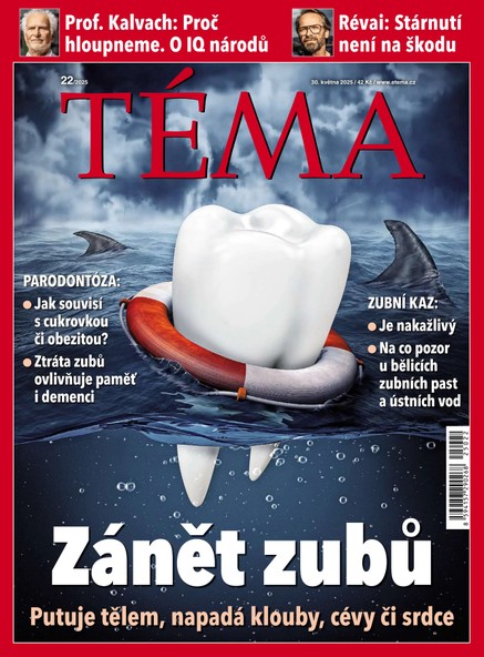 TÉMA DNES - 30.05.2025