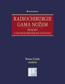 Radiochirurgie gama nožem