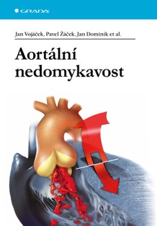 Aortální nedomykavost