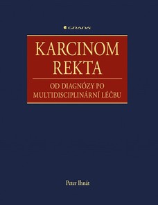 Karcinom rekta