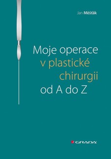 Moje operace v plastické chirurgii od A do Z