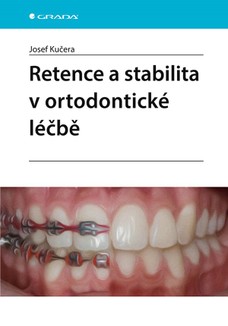 Retence a stabilita v ortodontické léčbě