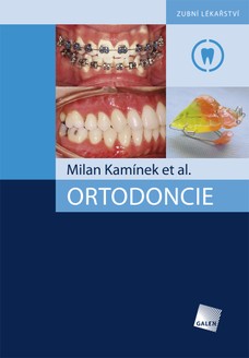 Ortodoncie