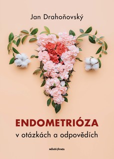 Endometrióza v otázkách a odpovědích