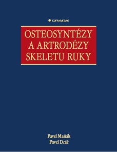 Osteosyntézy a artrodézy skeletu ruky