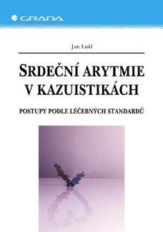 Srdeční arytmie v kazuistikách