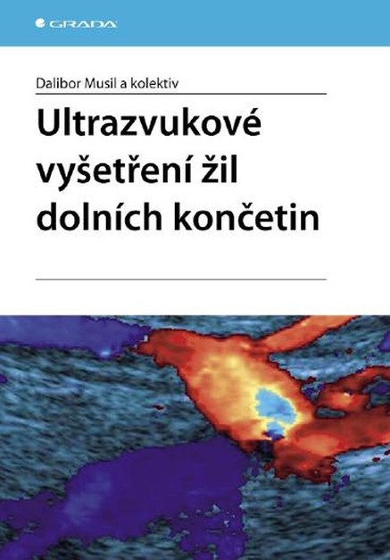 Ultrazvukové vyšetření žil dolních končetin