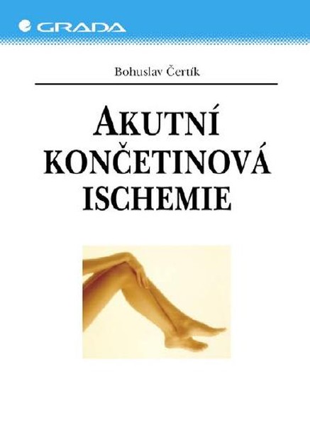 Akutní končetinová ischemie