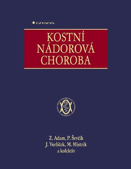 Kostní nádorová choroba