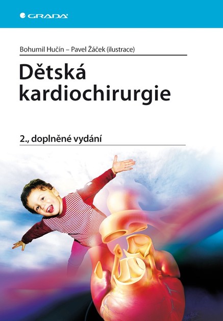 Dětská kardiochirurgie