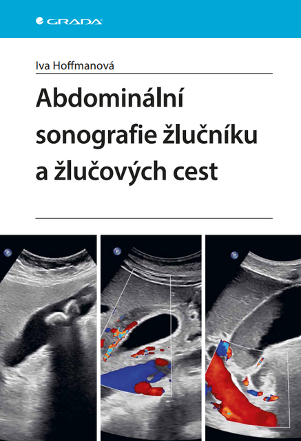 Abdominální sonografie žlučníku a žlučových cest