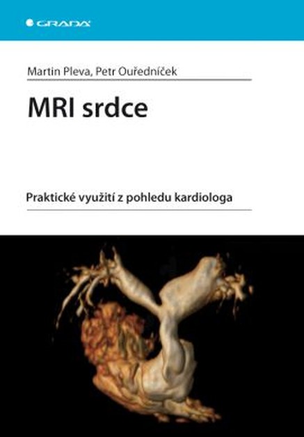 MRI srdce